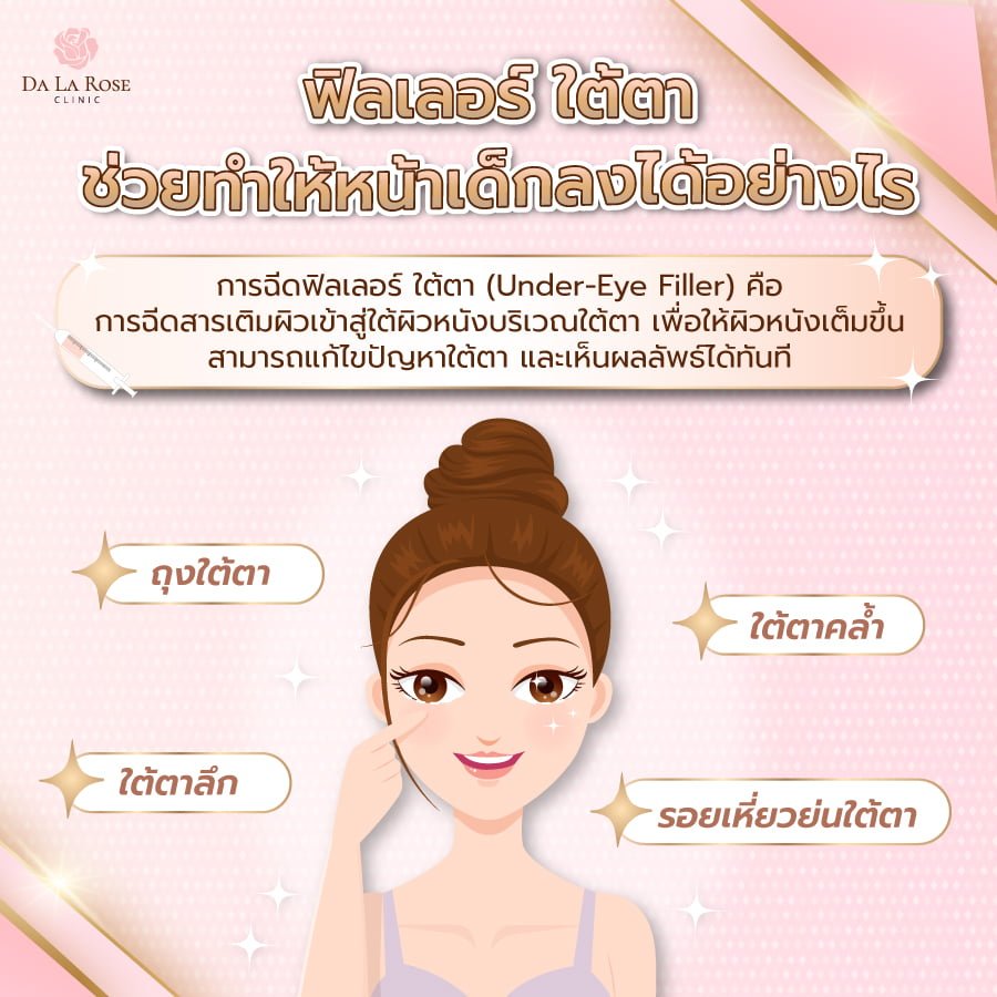 ฟิลเลอร์ ใต้ตา